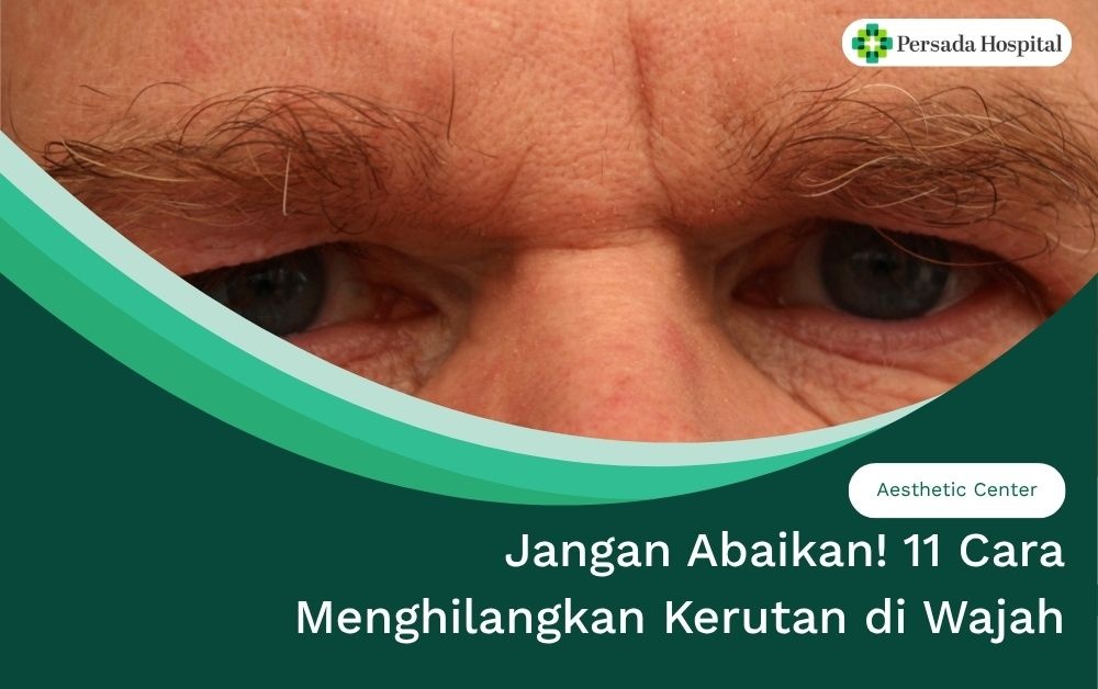 Jangan Abaikan! 11 Cara Menghilangkan Kerutan di Wajah