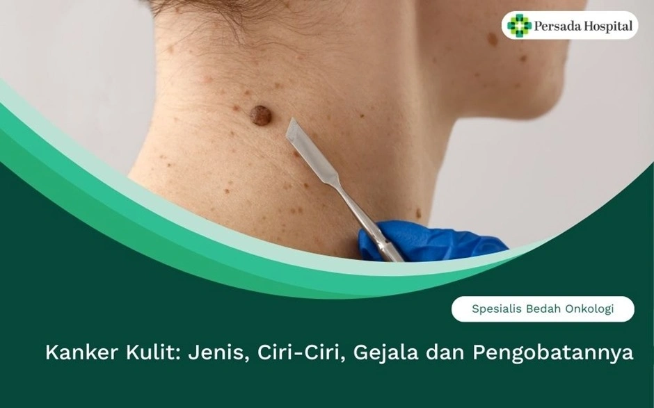 Kanker Kulit: Jenis, Ciri-Ciri, Gejala dan Pengobatannya