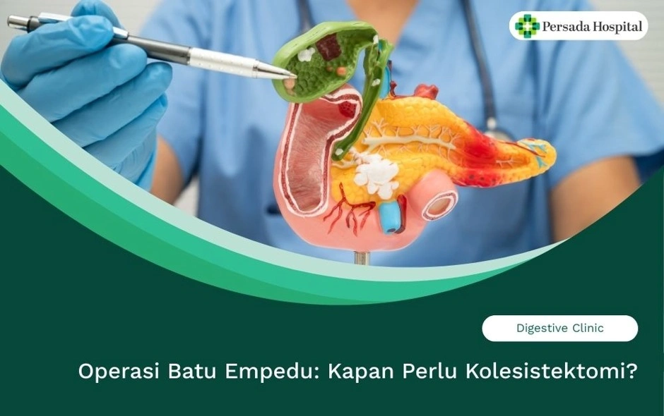 Operasi Batu Empedu: Kapan Perlu Kolesistektomi?