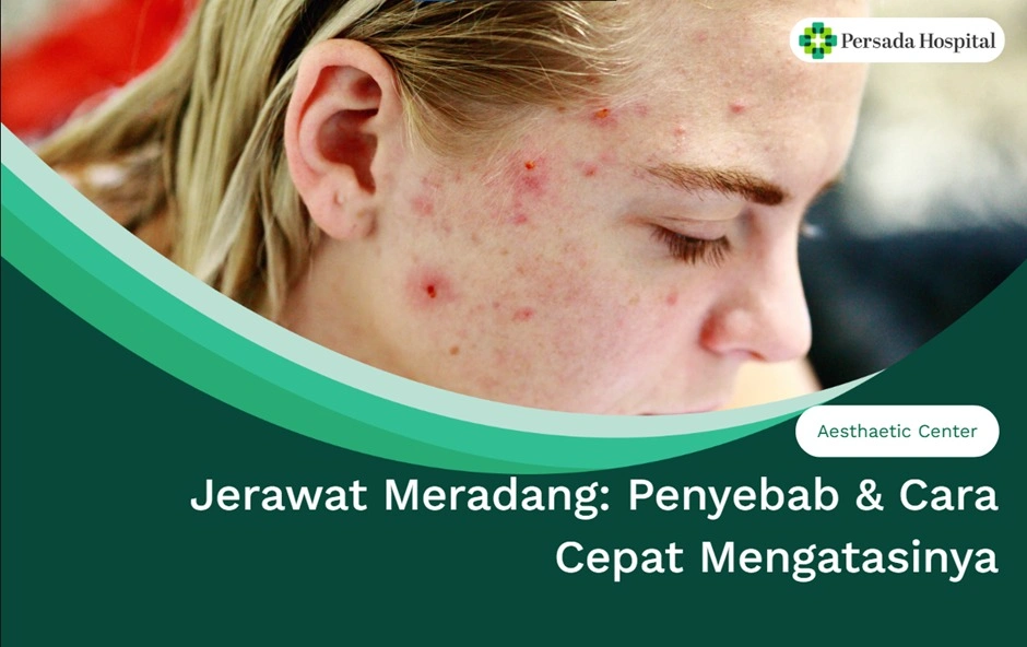 Jerawat Meradang: Penyebab & Cara Cepat Mengatasinya