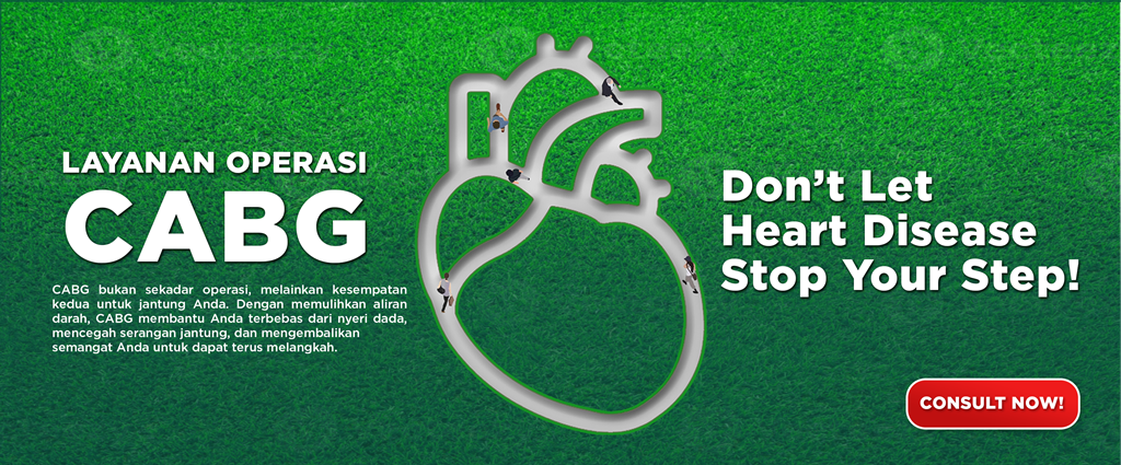 cabg, bypass, jantung