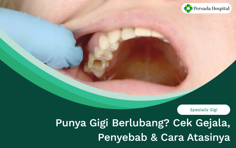 Punya Gigi Berlubang? Cek Gejala, Penyebab & Cara Atasinya