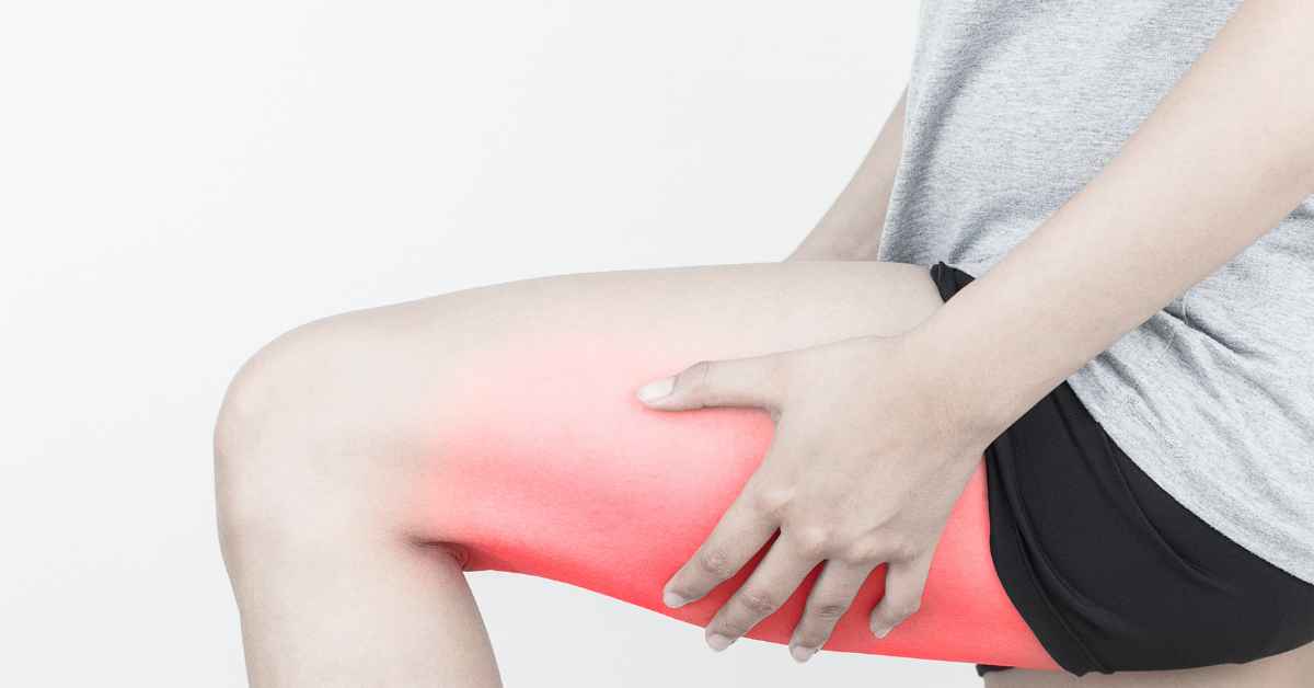Cedera Hamstring - Penyebab, Gejala, Pengobatan