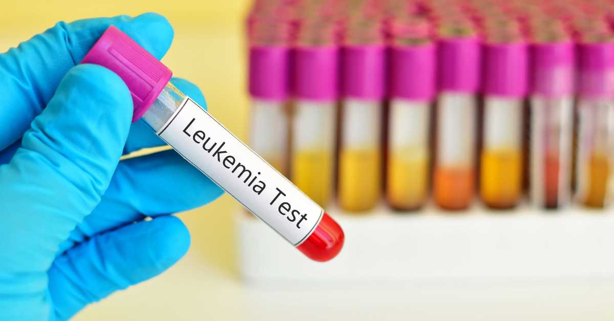 Leukemia: Penyebab, Gejala, dan Cara Mengobati