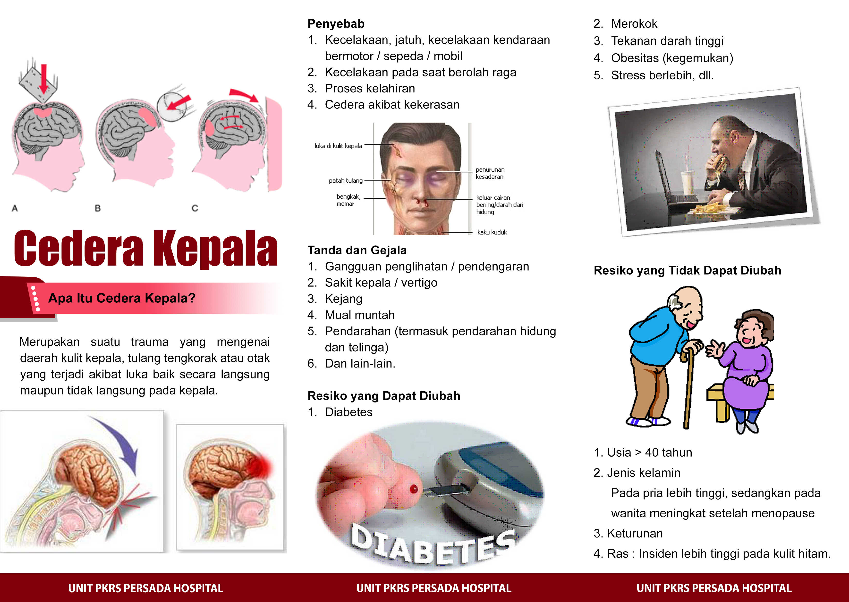 Cedera Kepala