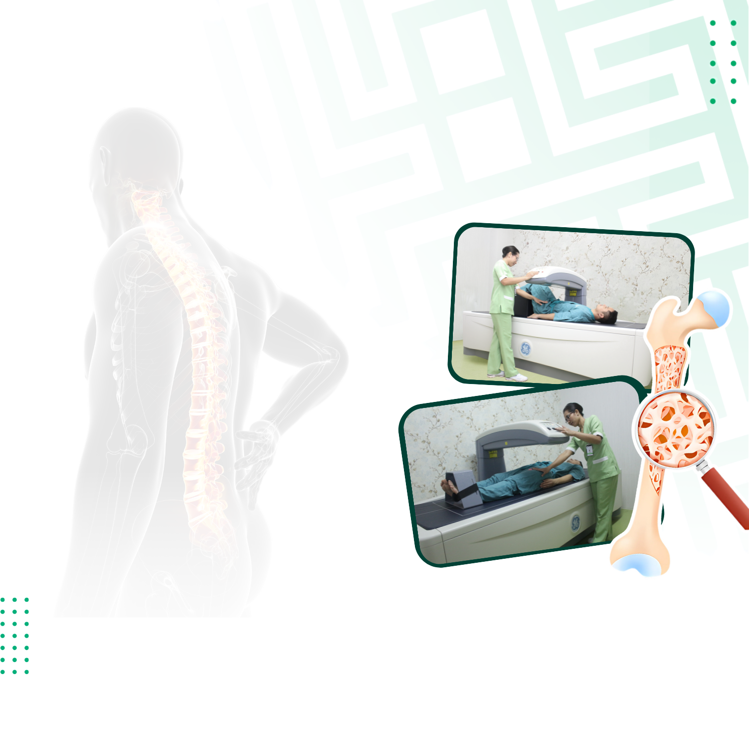 Promo Medical Check Up Bone Mineral Densitometry (BMD)
