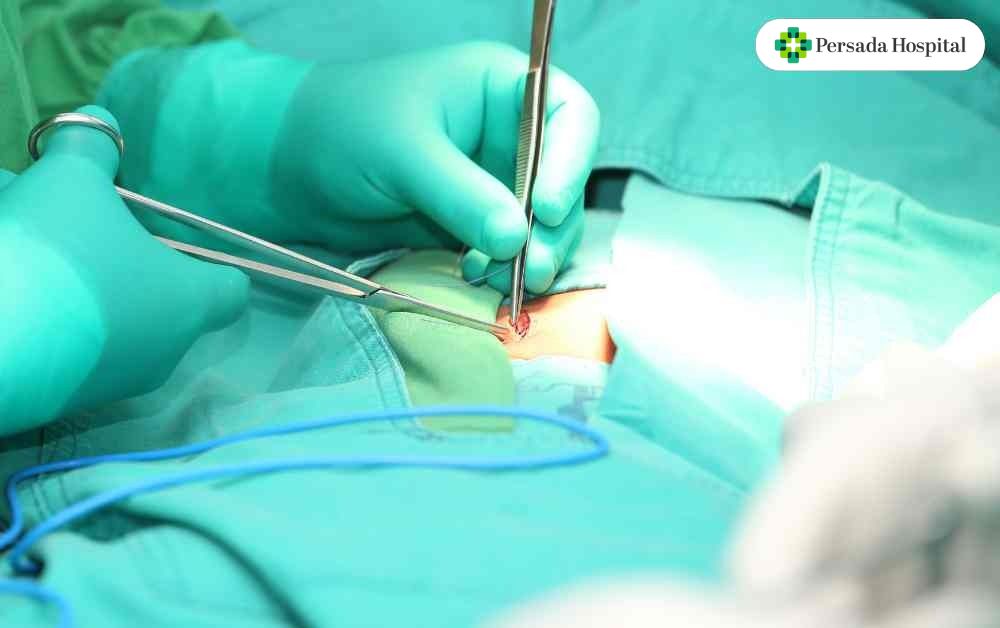 Bedah Laparoskopi Hernia