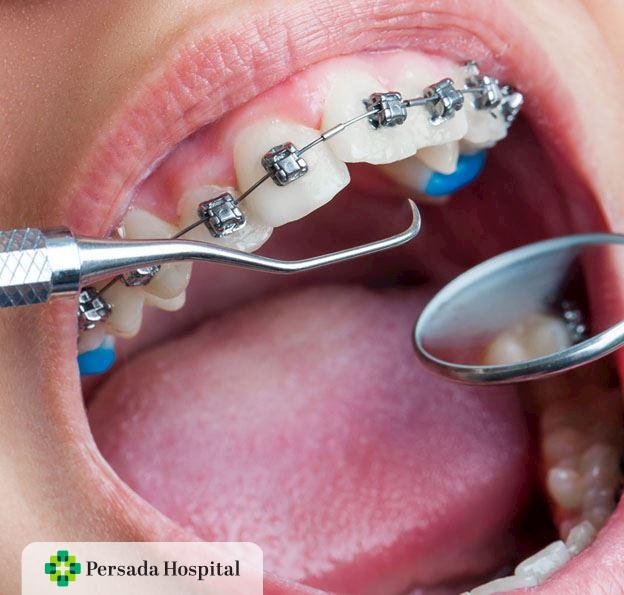 Dokter Gigi Spesialis Orthodonti
