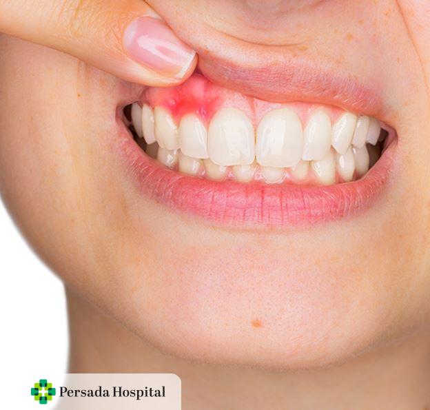 Dokter Gigi Spesialis Periodonti